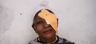 Fighting trachoma: Empowering communities for sustainable health solutions